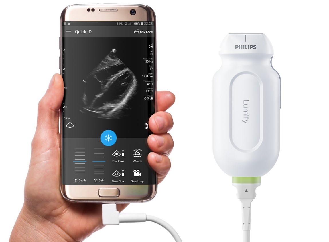 PHILIPS ULTRASOUND Lumify S4-1 Probe and Transducer